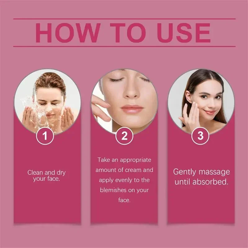 Whitening Freckle Melasma Dark Spots Pigmentation Removal Cream - Palm and Thread