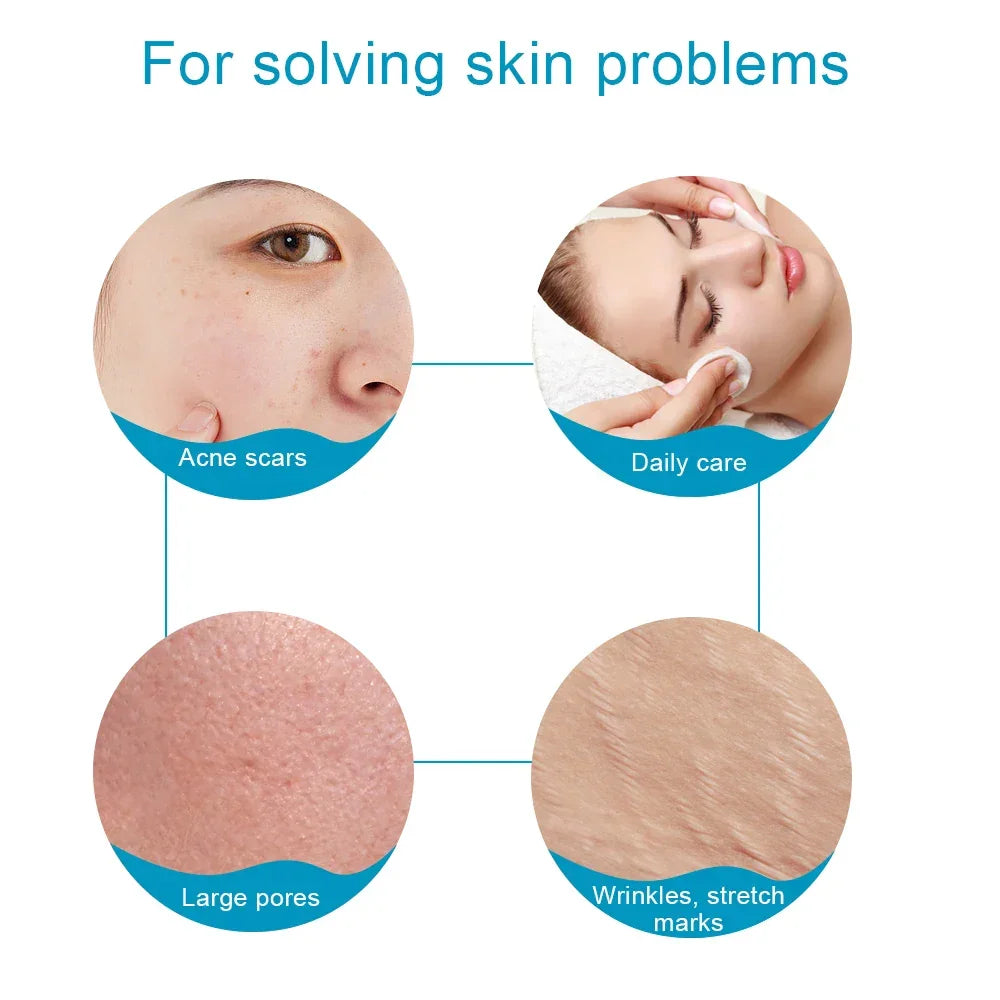Skin Facial Care Microneedle Derma Roller for Hair Growth - Palm and Thread