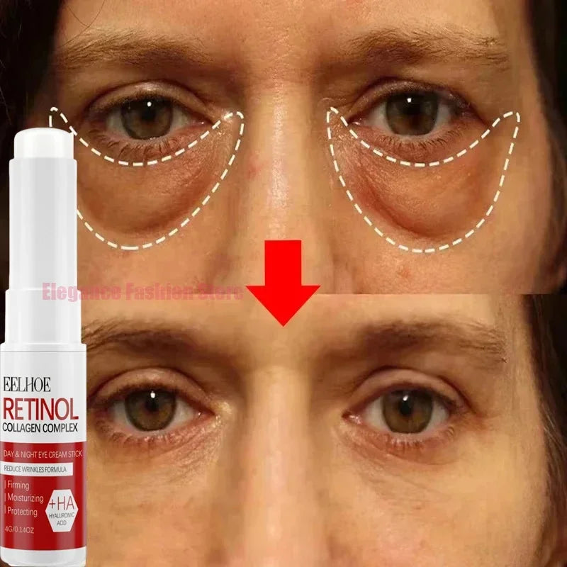 Instant Eye Bag Remove Eye Cream Anti Fat Particles Dark Circles - Palm and Thread