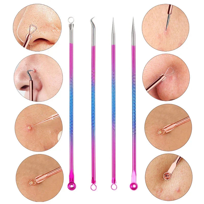 Black Spot Pimple Blemish Remover - Palm and Thread