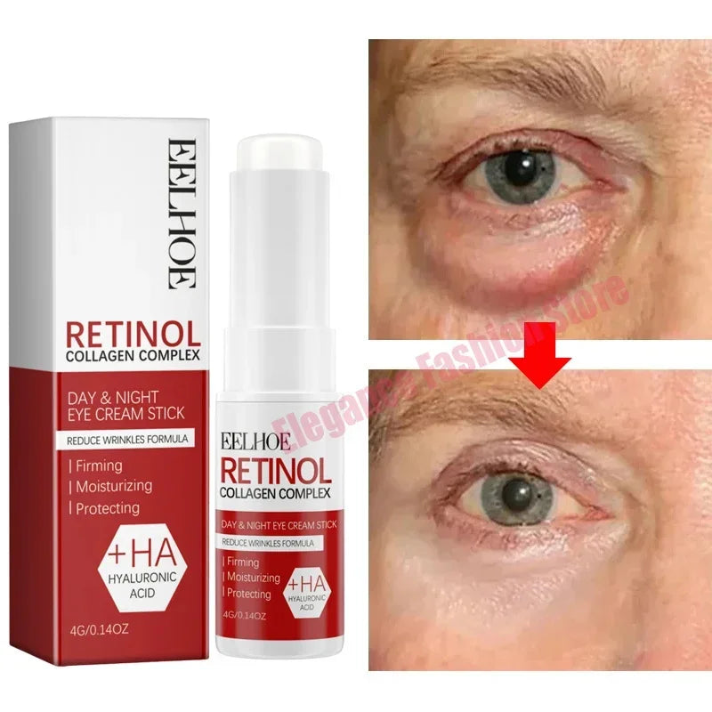 Instant Eye Bag Remove Eye Cream Anti Fat Particles Dark Circles - Palm and Thread
