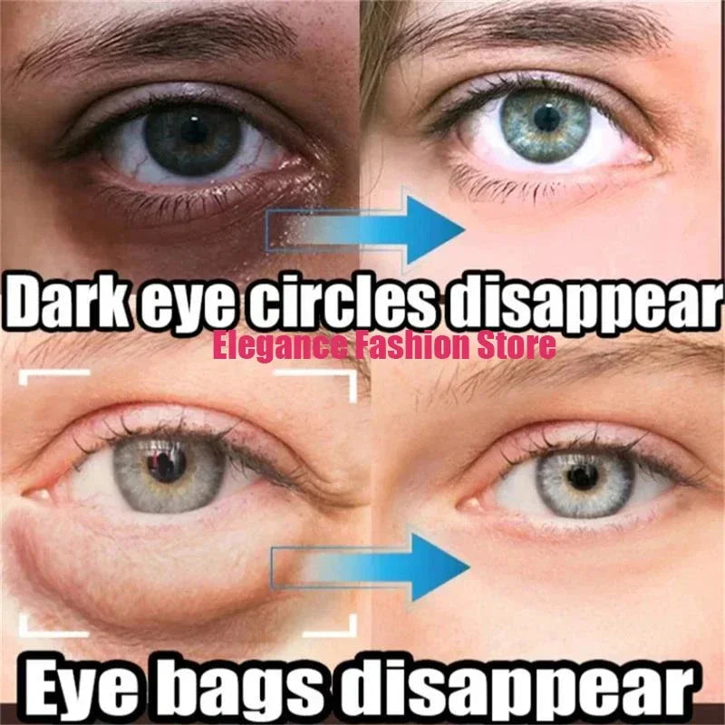 Instant Eye Bag Remove Eye Cream Anti Fat Particles Dark Circles - Palm and Thread