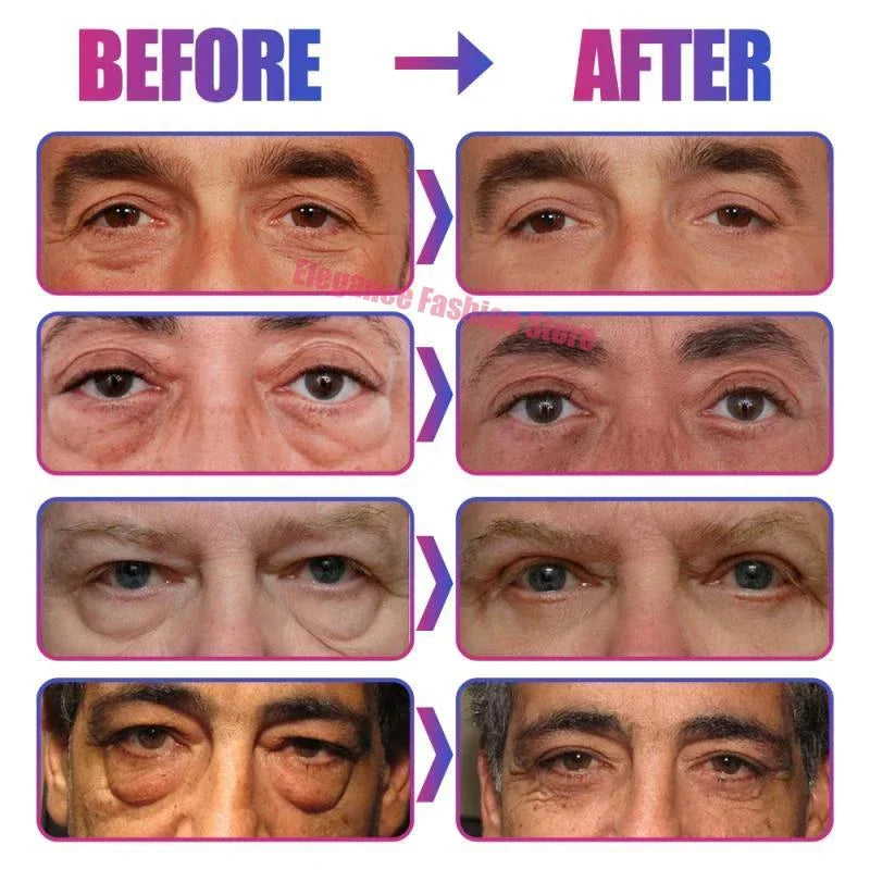Instant Eye Bag Remove Eye Cream Anti Fat Particles Dark Circles - Palm and Thread