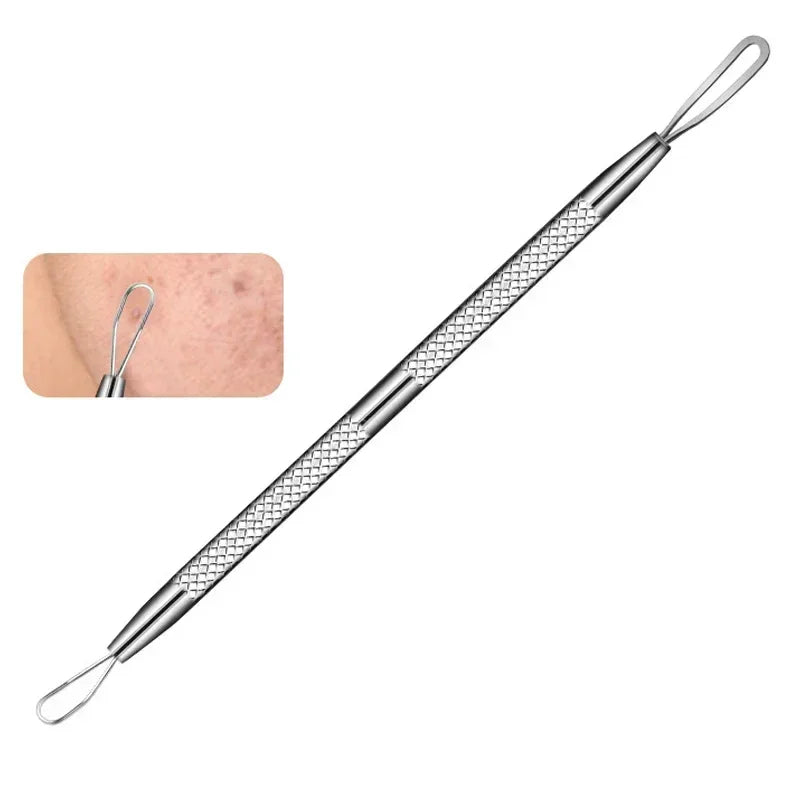 Stainless Steel Clip Pimples Tweezer Blackhead Remover - Palm and Thread