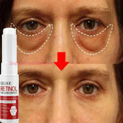Instant Eye Bag Remove Eye Cream Anti Fat Particles Dark Circles - Palm and Thread