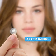 Invisible Pimple Removal Patches - Palm and Thread