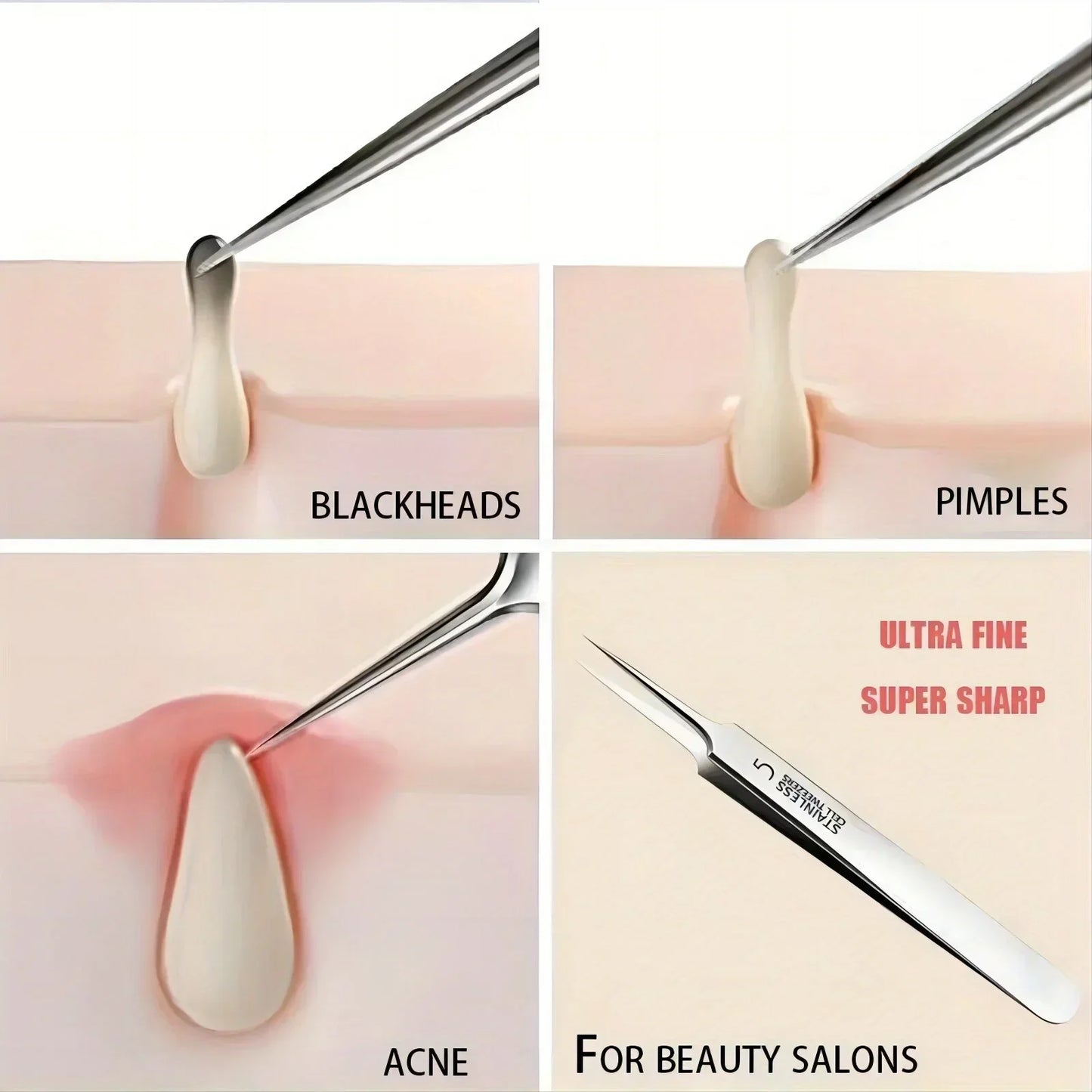 1 Pack Extra Fine No. 5 Cellular Acne Blackhead Tweezer - Palm and Thread