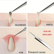 1 Pack Extra Fine No. 5 Cellular Acne Blackhead Tweezer - Palm and Thread