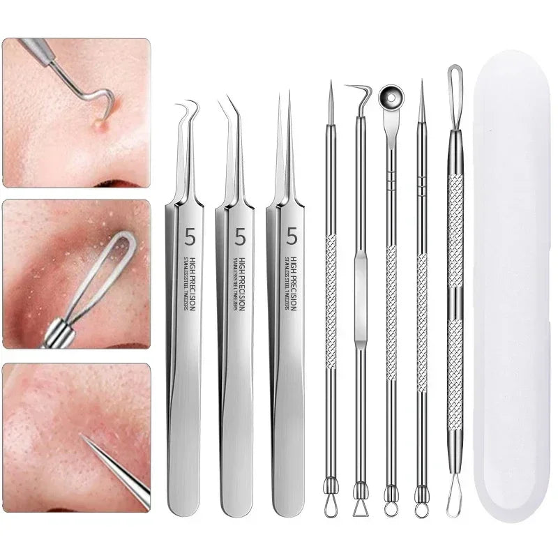 Stainless Steel Clip Pimples Tweezer Blackhead Remover - Palm and Thread