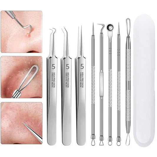 Stainless Steel Clip Pimples Tweezer Blackhead Remover - Palm and Thread