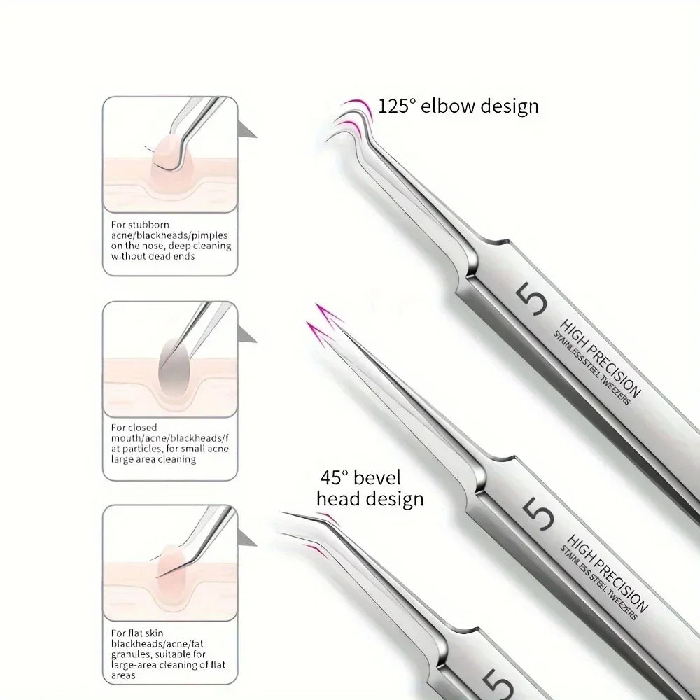 Stainless Steel Blackhead Removal Tool Set - Palm and Thread