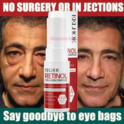 Instant Eye Bag Remove Eye Cream Anti Fat Particles Dark Circles - Palm and Thread