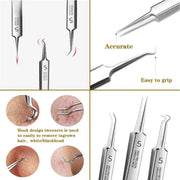 Ultra-fine Cell Pimples Blackhead Clip Tweezer - Palm and Thread