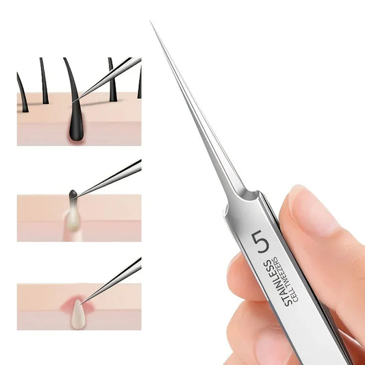 1 Pack Extra Fine No. 5 Cellular Acne Blackhead Tweezer - Palm and Thread